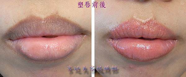 唇3.jpg