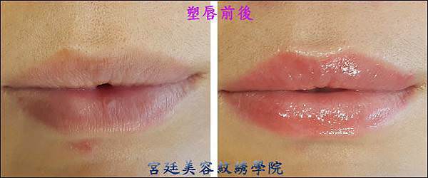 唇2.jpg
