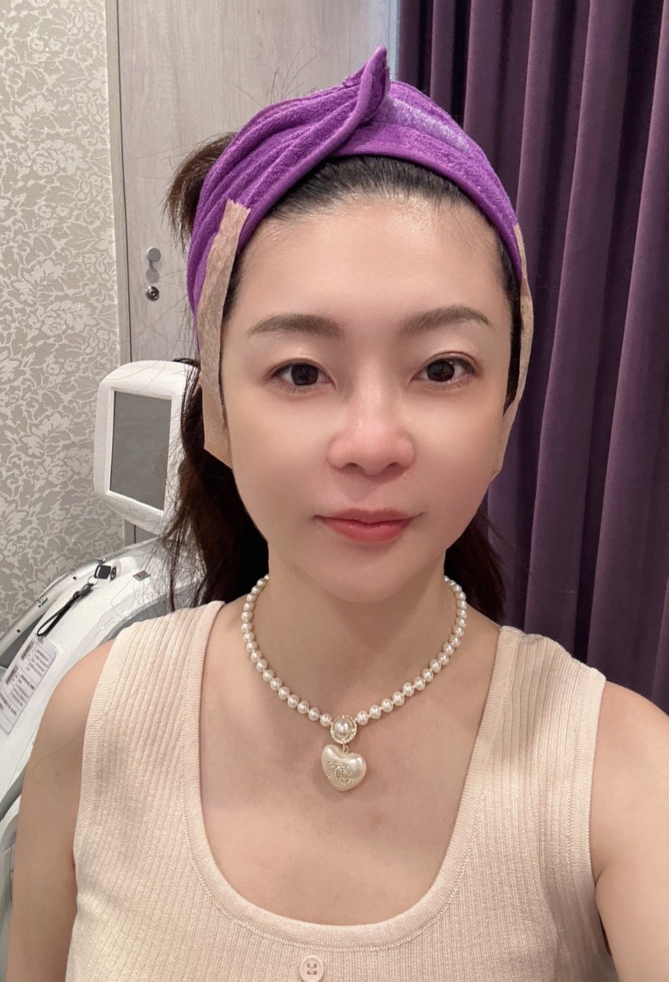 【台中Z音波】佳思優整形外科美學診所│法令木偶紋消去法,中下臉提拉更快速有感 - 第16張圖
